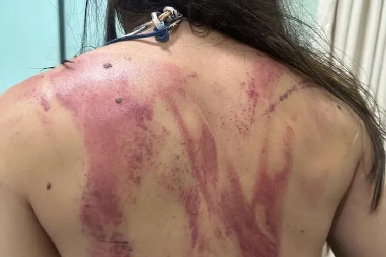 'Seria meu último dia', diz mulher que quase foi morta pelo próprio pai no Pará