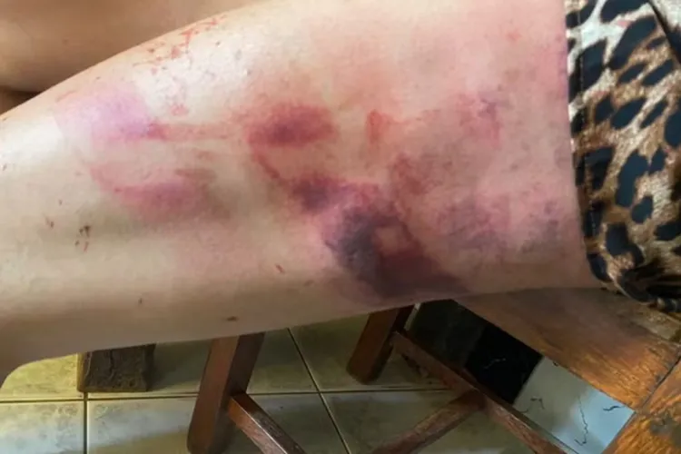 'Seria meu último dia', diz mulher que quase foi morta pelo próprio pai no Pará