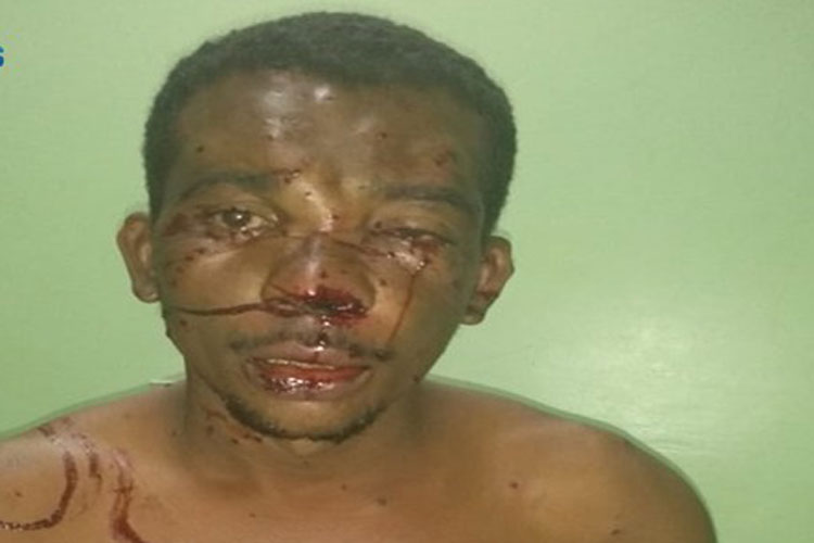 Homem tenta matar o próprio irmão com tiro de espingarda em Palmas de Monte Alto