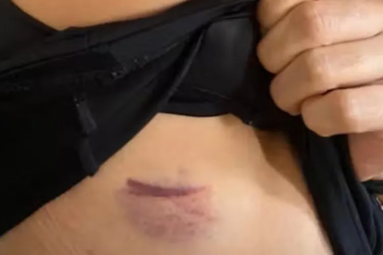 Itabuna: Servidor público agride ex-namorada com socos, chutes e puxões de cabelo