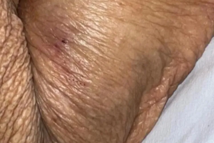 Idosa de 84 anos sofre fratura no braço durante atendimento em UPA de Caetité