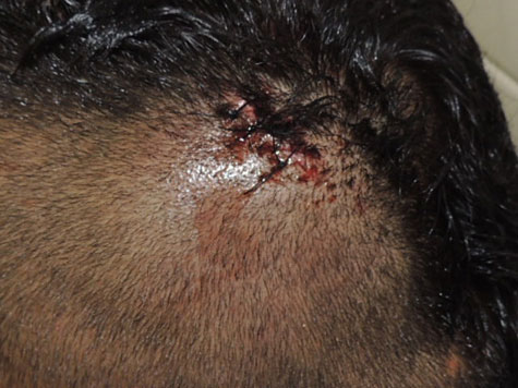 Brumado: Bandido tentou roubar goleiro, mas levou surra e foi detido