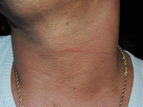 Brumado: Motociclista tem pescoço arranhado por linha de pipa