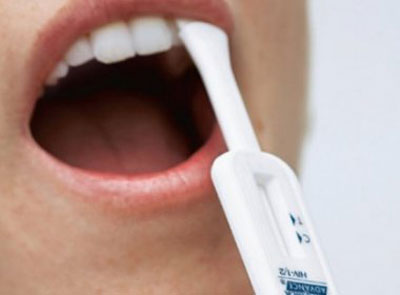 Teste de Aids a ser vendido em farmácias em 2014 vai custar R$ 8