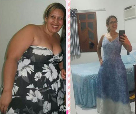 História de superação de brumadense que perdeu 63 Kg repercute na internet