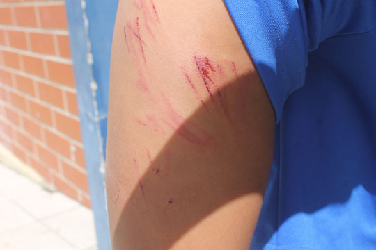 Brumado: Mãe espanca filha de oito anos com mangueira por ter comido pão do irmão