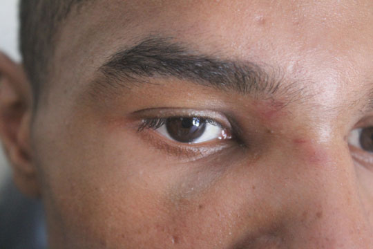 Entregador de água é apedrejado e espancado por bandidos a cavalo em Brumado