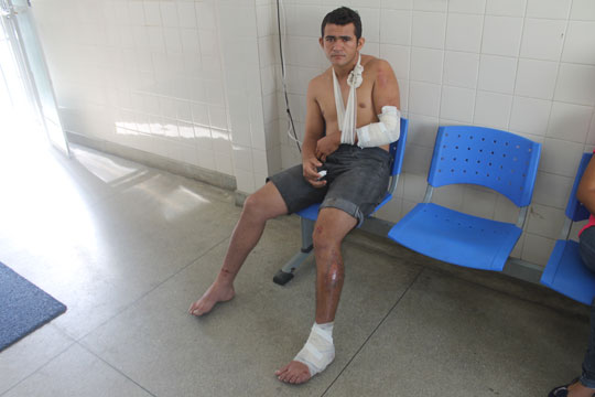 Brumado: Motociclista fica ferido após ser atingido por fio de eletricidade da Coelba