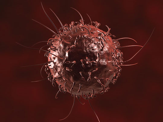 Dois terços dos tipos de câncer começam de forma aleatória por mutação genética