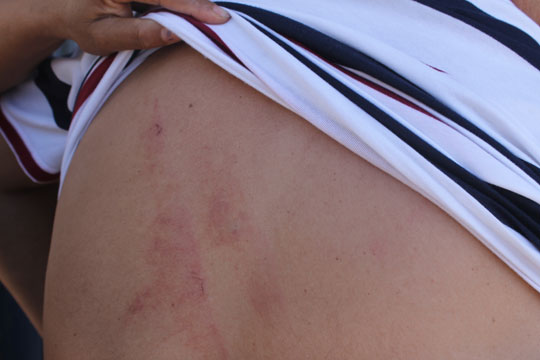 Casal é brutalmente agredido durante assalto a bar em Brumado