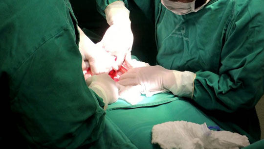 Ministério da Saúde: Brasil vive epidemia de cesarianas