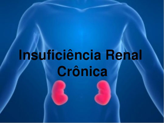Doença renal crônica atinge 10% da população mundial