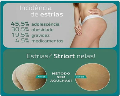 Clínica Mais Vida: Esteticista Iasmin Ferraz esclarece dúvidas sobre tratamento para estrias
