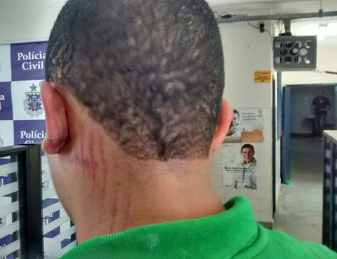 Brumado: Fotógrafo briga com lutador de MMA e sai desmaiado após receber golpe de capacete