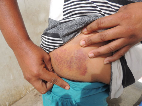 Brumado: Mulher leva surra de amante do companheiro