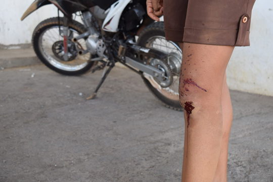 Gerente de funerária de Barra da Estiva é baleado em tentativa de roubo de moto em Brumado