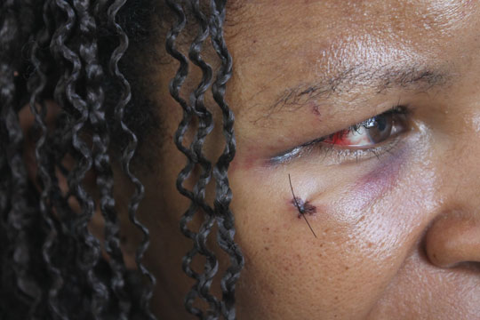 Brumado: Homem embriagado foge após esfaquear esposa e filha no Bairro Baraúnas