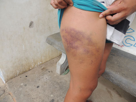 Brumado: Mulher leva surra de amante do companheiro