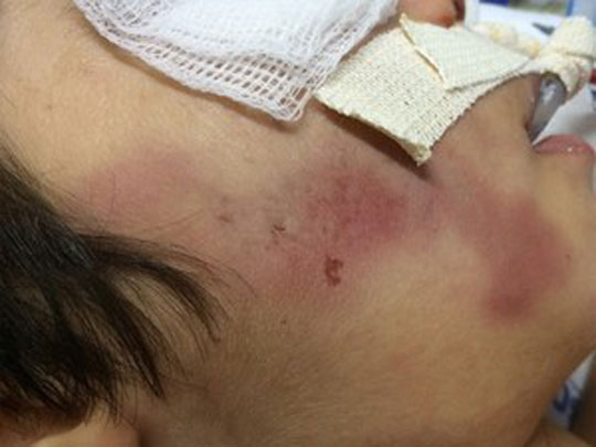 Mãe espanca filho de 5 anos após garoto defecar na cama: 'me estressei'