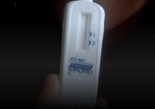 Ministério da Saúde começa distribuição de teste oral de HIV