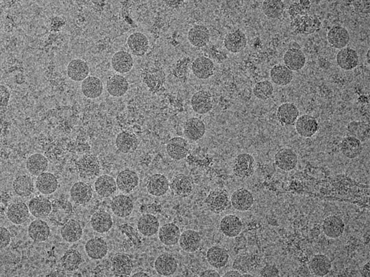 Vírus zika pode ter ligação com outra doença neurologia