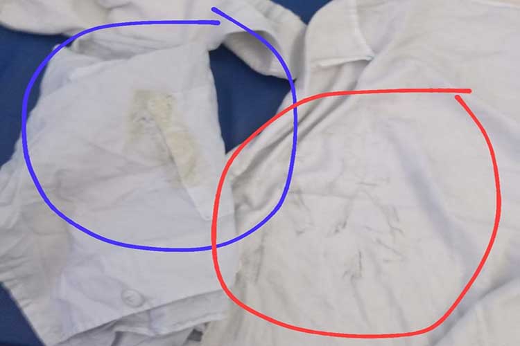 Denúncia aponta roupas sujas e sem condições de uso no Hospital Geral de Guanambi