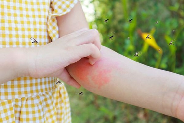 Chikungunya é mais mortífera do que se imaginava