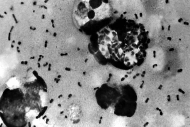 Depois de Covid-19, China reporta caso de peste bubônica