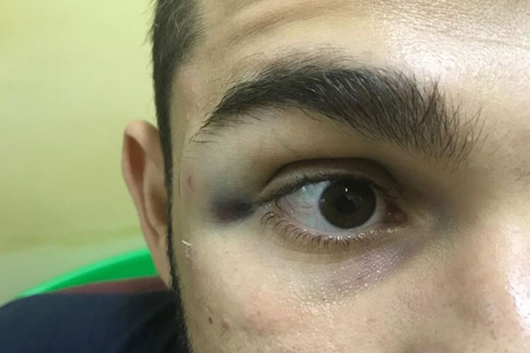 Livramento: Advogado é agredido por policial militar na sede da 46ª CIPM