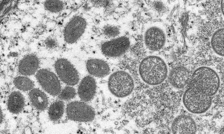 Ministério da Ciência investe R$ 3 milhões em pesquisas sobre varíola dos macacos