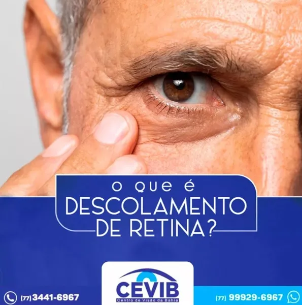 Cevib explica o que é descolamento de retina e quais os sintomas mais comuns da alteração