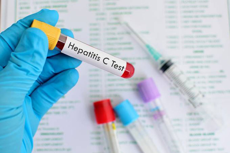 Hepatite: O número de infecções não para de crescer no Brasil e no mundo