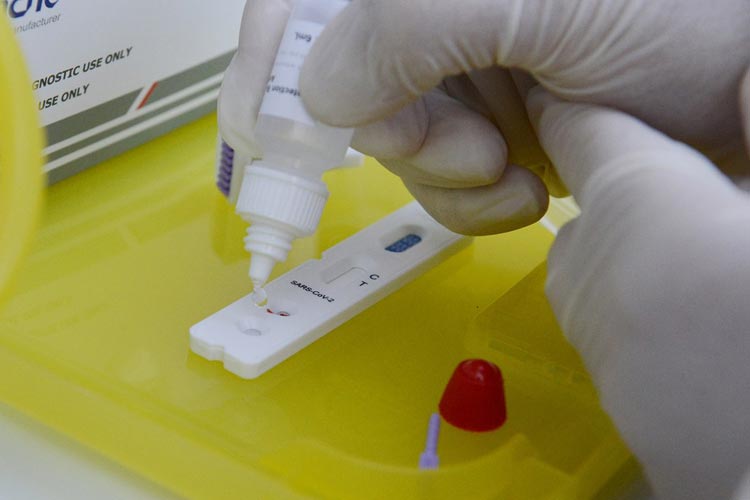 Bahia confirma 1.219 casos de coronavírus em 24h e número de infectados chega a 37,6 mil