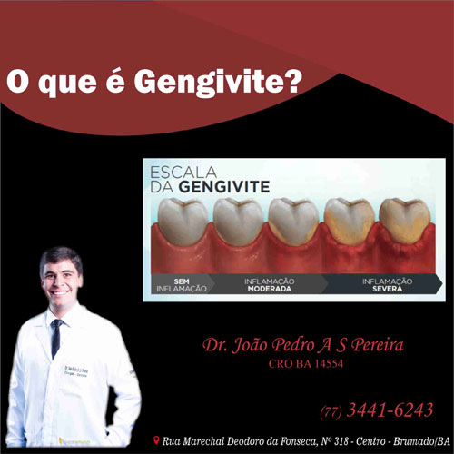 Gengivite: Confira as dicas de João Pedro Amorim