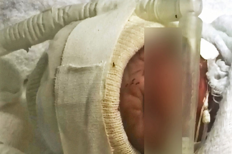 Formigas atacam bebês em incubadora neonatal de hospital em Belo Horizonte