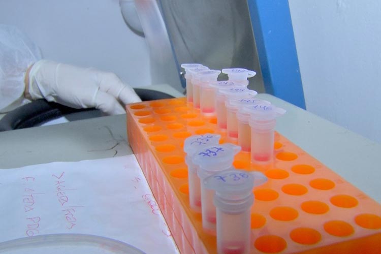 Médico que atendeu paciente com coronavírus é o 17º caso confirmado na Bahia