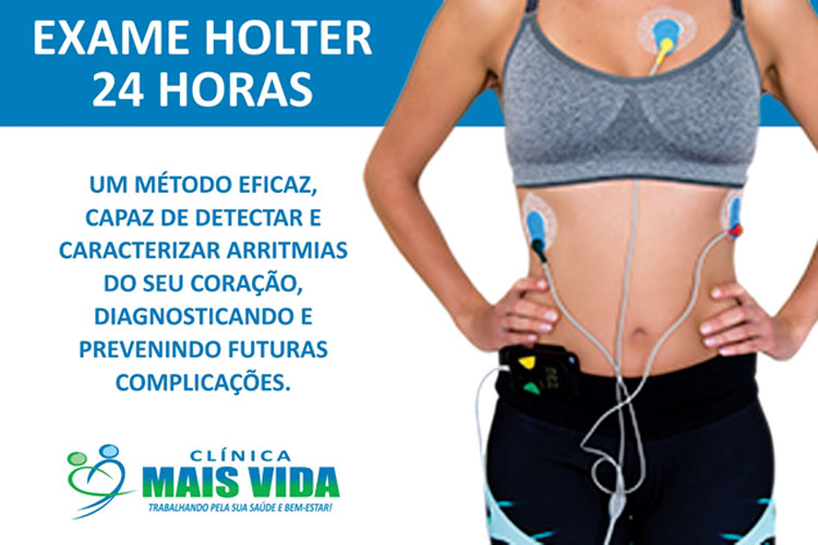 Cuide de seu coração na Clínica Mais Vida – A importância do exame de Holter