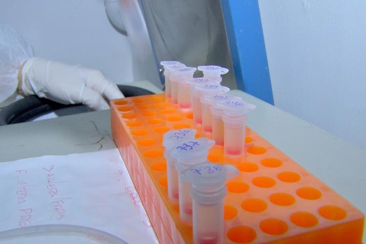 Quatro novos casos de coronavírus são confirmados na Bahia