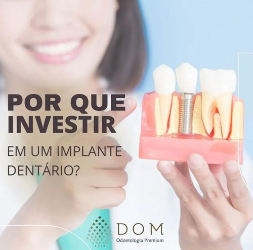 Dom Odontologia Premium tem o melhor do mercado em implantes dentários em Brumado