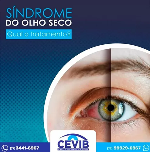 Cevib: Saiba quais os tratamentos indicados para o famoso olho seco