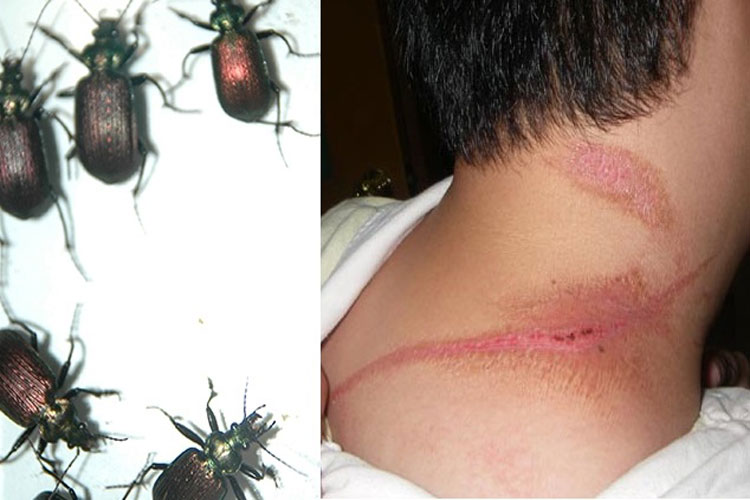 Vários pontos de infestação do besouro conhecido como potó são relatados em Caculé