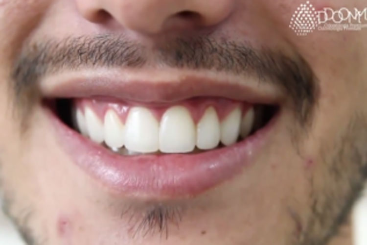 Conquiste o sorriso que sempre sonhou na Dom Odontologia Premium em Brumado