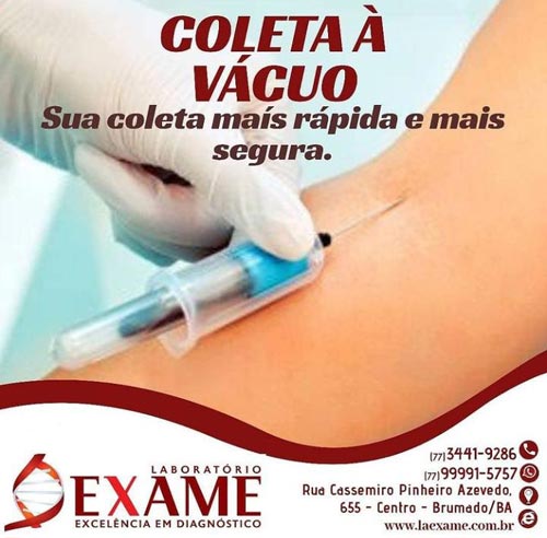 Coleta de sangue à vácuo: Mais rápida e mais segura no Laboratório Exame