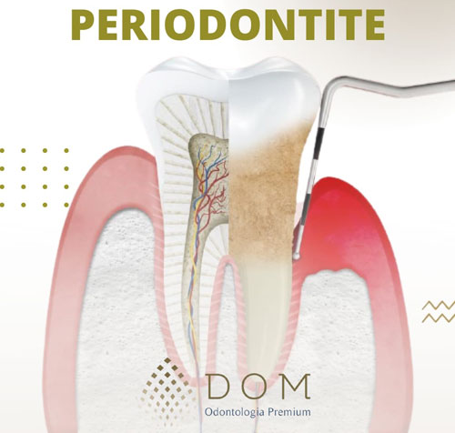 Dom Odontologia Premium: Visitar o dentista com maior frequência é essencial para manter a saúde bucal