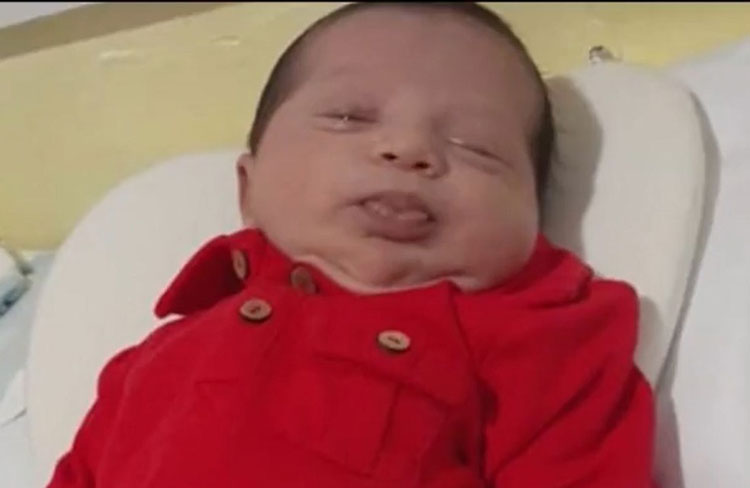 Bebê que recebeu transfusão de plaquetas após ser diagnosticado com Covid-19 tem alta médica