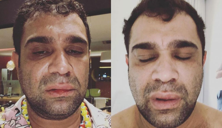 Humorista registra queixa por homofobia após agressão em show