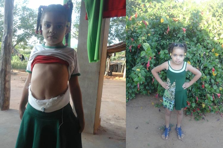 Livramento de Nossa Senhora: Mãe pede ajuda para realizar três cirurgias da filha de seis anos