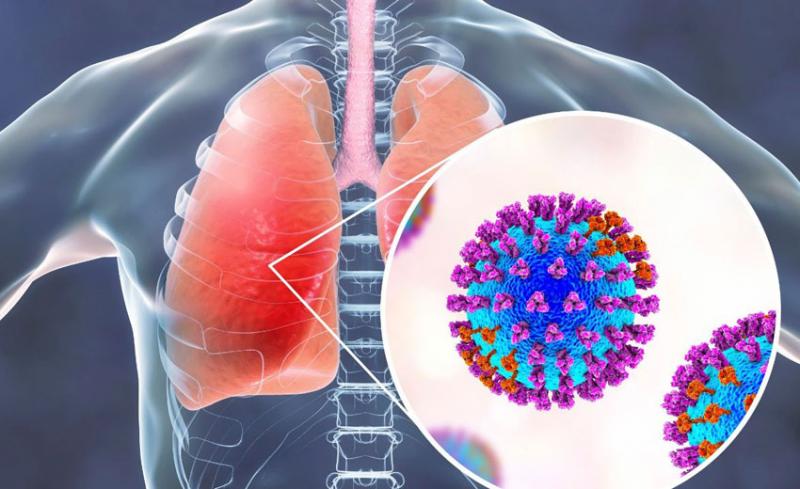 Bahia confirma segunda morte pela Influenza H3N2