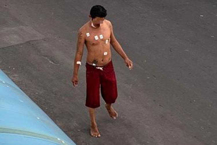 Internado por Covid-19, morador de rua foge do hospital no interior do Amazonas e pega mototáxi