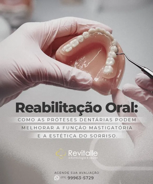 Revitalle Odontologia destaca benefícios das próteses dentárias para reabilitação oral